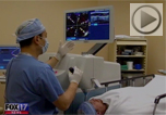 wsmv laser cataract